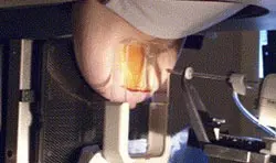 Vakum biyopsi nedir ?